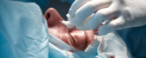 Lower Blepharoplasty vs Under-Eye Fillers in India: Which One Actually Fits Genetic Eye Bags